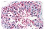 FSHR Antibody in Immunohistochemistry (Paraffin) (IHC (P))