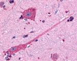 DRD2 Antibody in Immunohistochemistry (Paraffin) (IHC (P))