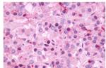 NMBR Antibody in Immunohistochemistry (Paraffin) (IHC (P))