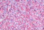 NMBR Antibody in Immunohistochemistry (Paraffin) (IHC (P))