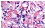 HRH2 Antibody in Immunohistochemistry (Paraffin) (IHC (P))