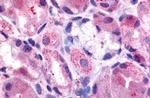 HRH2 Antibody in Immunohistochemistry (Paraffin) (IHC (P))