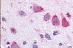 TAOK1 Antibody in Immunohistochemistry (Paraffin) (IHC (P))