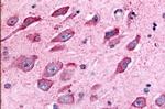 TAOK1 Antibody in Immunohistochemistry (Paraffin) (IHC (P))