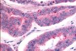 TAOK1 Antibody in Immunohistochemistry (Paraffin) (IHC (P))