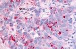 Cdc7 Antibody in Immunohistochemistry (Paraffin) (IHC (P))