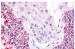 Cdc7 Antibody in Immunohistochemistry (Paraffin) (IHC (P))