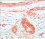 FGFR1 Antibody in Immunohistochemistry (Paraffin) (IHC (P))