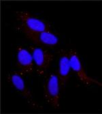 FGFR2 Antibody in Immunocytochemistry (ICC/IF)