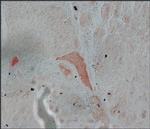 FGFR2 Antibody in Immunohistochemistry (Paraffin) (IHC (P))