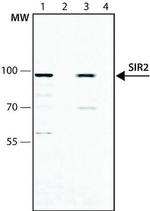 SIRT2 Antibody in Western Blot (WB)