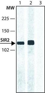 SIRT2 Antibody in Western Blot (WB)