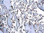 hCG beta Antibody in Immunohistochemistry (Paraffin) (IHC (P))