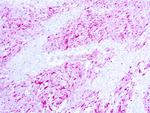 S100 Antibody in Immunohistochemistry (Paraffin) (IHC (P))