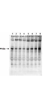 Phospho-GYS1 (Ser640) Antibody in Western Blot (WB)