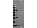 Catalase Antibody in Western Blot (WB)