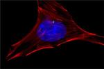 gamma Tubulin Antibody in Immunocytochemistry (ICC/IF)