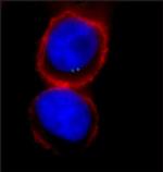 gamma Tubulin Antibody in Immunocytochemistry (ICC/IF)