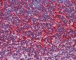 TAP1 Antibody in Immunohistochemistry (IHC)