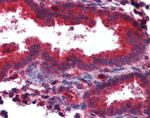 TAP1 Antibody in Immunohistochemistry (IHC)