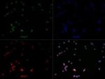 TLR7 Antibody in Immunocytochemistry (ICC/IF)