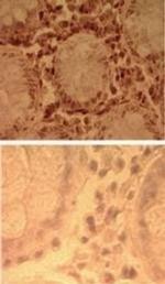 TLR7 Antibody in Immunohistochemistry (Paraffin) (IHC (P))