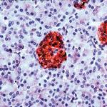 NSE Antibody in Immunohistochemistry (Paraffin) (IHC (P))