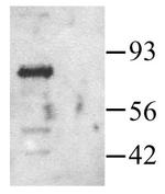 PAK1 Antibody in Western Blot (WB)