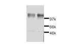 Leptin Receptor Antibody in Western Blot (WB)