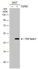 TGF beta-1 Antibody in Western Blot (WB)