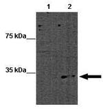 MBD2 Antibody in Western Blot (WB)