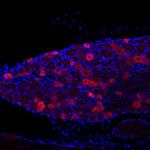 TRPV1 Antibody in Immunohistochemistry (IHC)