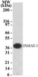 SET Antibody in Western Blot (WB)