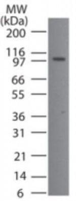 TMEM123 Antibody in Western Blot (WB)