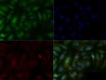 SMAD6 Antibody in Immunocytochemistry (ICC/IF)