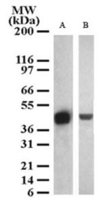 SETD7 Antibody in Western Blot (WB)