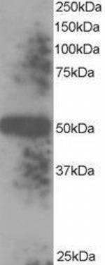 TXNDC5 Antibody in Western Blot (WB)