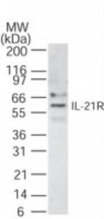 IL21R Antibody in Western Blot (WB)