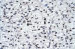 GLI2 Antibody in Immunohistochemistry (Paraffin) (IHC (P))