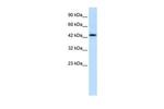 DLX2 Antibody in Western Blot (WB)