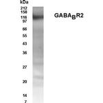 GABBR2 Antibody in Western Blot (WB)