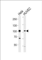 EphA4 Antibody in Western Blot (WB)