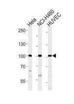 EphA4 Antibody in Western Blot (WB)