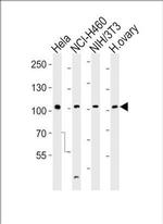 EphA4 Antibody in Western Blot (WB)