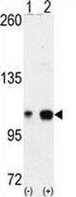 EphA4 Antibody in Western Blot (WB)