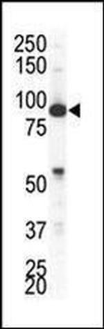 EphA4 Antibody in Western Blot (WB)