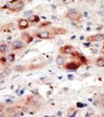 VPS34 Antibody in Immunohistochemistry (Paraffin) (IHC (P))