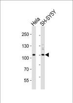 VPS34 Antibody in Western Blot (WB)