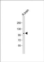 MCK10 Antibody in Western Blot (WB)