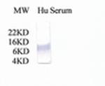 Complement C3a Antibody in Western Blot (WB)